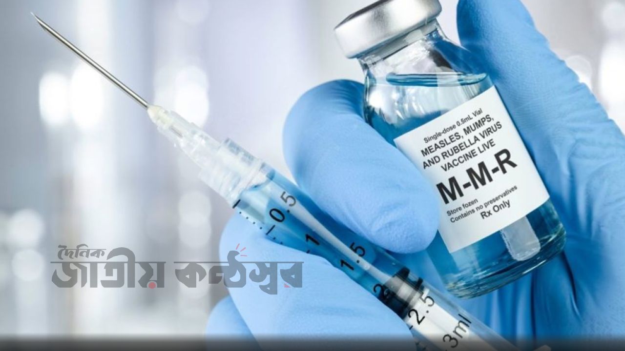 রোববার থেকে ১৮ জেলায় হামের টিকাদান শুরু — ঈদের আগেই সারাদেশে সম্প্রসারণের পরিকল্পনা