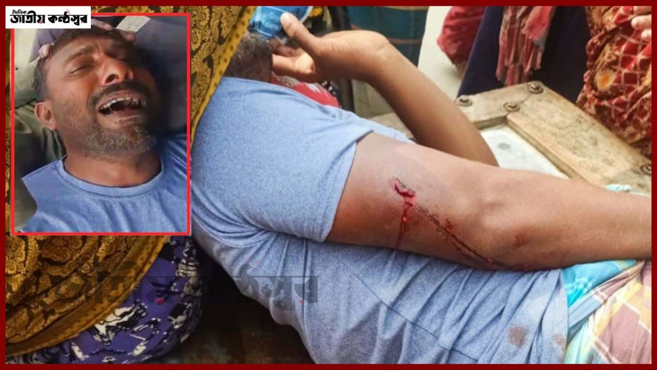 যশোরে চাঁদার দাবিতে যুবককে তুলে নিয়ে হাতুড়িপেটা, গুরুতর আহত